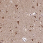 Immunohistochemical staining of human cerebral cortex shows moderate granular cytoplasmic positivity in neurons.