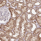 Immunohistochemical staining of human kidney shows moderate granular cytoplasmic positivity in cells in tubules.