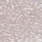 Immunohistochemical staining of human liver shows weak granular cytoplasmic positivity in hepatocytes.