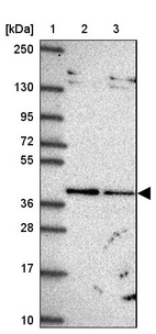 Lane 1: Marker [kDa] 250, 130, 95, 72, 55, 36, 28, 17, 10_br/_Lane 2: Human cell line RT-4_br/_Lane 3: Human cell line U-251 MG
