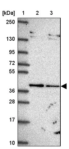 Lane 1: Marker [kDa] 250, 130, 95, 72, 55, 36, 28, 17, 10_br/_Lane 2: Human cell line RT-4_br/_Lane 3: Human cell line U-251 MG
