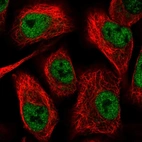 Immunofluorescent staining of human cell line A549 shows localization to nucleoplasm.