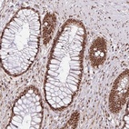 Anti-LKAAEAR1 Antibody