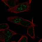 Anti-LKAAEAR1 Antibody