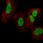 Immunofluorescence staining of CACO-2 cells using the Anti-CDX2 monoclonal antibody, showing specific staining in nucleoplasm in green. Microtubule is visualized in red (where available).