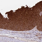 Immunohistochemical staining of human urinary bladder shows strong cytoplasmic positivity in urothelial cells.