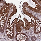 Immunohistochemical staining of human colon shows strong cytoplasmic positivity in glandular cells.
