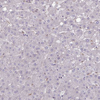 Anti-GLTP Antibody