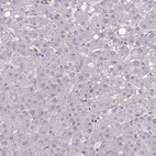 Immunohistochemical staining of human liver shows no cytoplasmic positivity in hepatocytes as expected.
