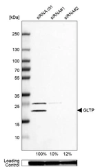 Western blot analysis in U-87MG ATCC cells transfected with control siRNA, target specific siRNA probe #1 and #2, using Anti-GLTP antibody. Remaining relative intensity is presented. Loading control: Anti-GAPDH.