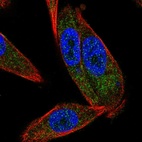 Immunofluorescent staining of human cell line PC-3 shows localization to cytosol.