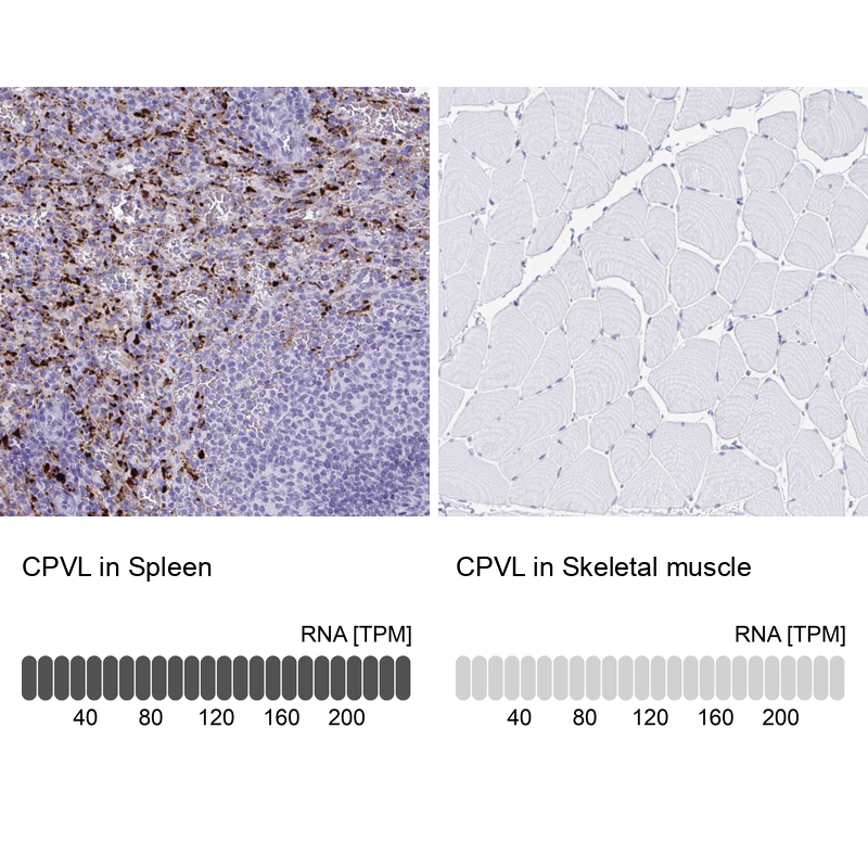 Anti-CPVL Antibody