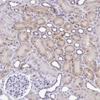 Immunohistochemical staining of human kidney shows strong cytoplasmic granular positivity in cells in tubules.