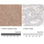 Anti-L1CAM Antibody