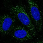 Anti-PBX4 Antibody