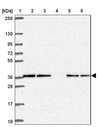 Lane 1: Marker [kDa] 250, 130, 95, 72, 55, 36, 28, 17, 10_br/_Lane 2: Human cell line RT-4_br/_Lane 3: Human cell line U-251MG sp_br/_Lane 4: Human plasma (IgG/HSA depleted)_br/_Lane 5: Human liver tissue_br/_Lane 6: Human tonsil tissue