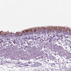 Anti-DNAH11 Antibody