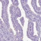 Immunohistochemical staining of human fallopian tube shows moderate positivity in ciliated glandular cells.