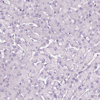 Anti-DNAH11 Antibody