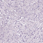 Immunohistochemical staining of human liver shows no positivity in hepatocytes as expected.