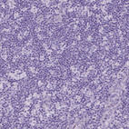 Anti-DNAH11 Antibody