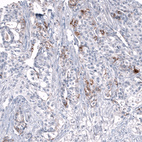 Anti-L1CAM Antibody