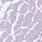 Immunohistochemical staining of human skeletal muscle shows no positivity in myocytes as expected.