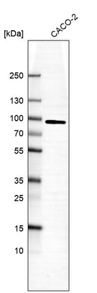 Anti-PFKP Antibody