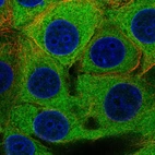 Immunofluorescent staining of human cell line MCF7 shows localization to cytosol.