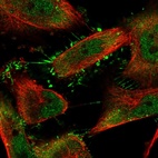 Immunofluorescent staining of human cell line U-251 MG shows localization to nucleoplasm, plasma membrane & cytosol.