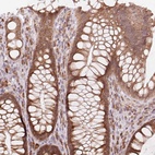 Anti-TECR Antibody