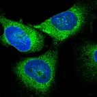 Immunofluorescent staining of human cell line U-251 MG shows localization to endoplasmic reticulum.