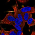 Anti-RGS17 Antibody