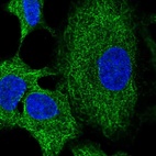 Anti-RNF215 Antibody