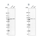 Anti-PABPC4 Antibody