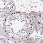 Anti-RHOXF1 Antibody