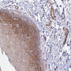 Anti-KLC3 Antibody