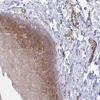 Anti-KLC3 Antibody