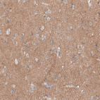 Immunohistochemical staining of human cerebral cortex shows moderate positivity in neuropil.
