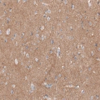 Immunohistochemical staining of human cerebral cortex shows moderate positivity in neuropil.