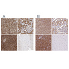 Immunohistochemical staining of human adrenal gland, kidney, pancreas and skeletal muscle using Anti-PACSIN2 antibody HPA056520 (A) shows similar protein distribution across tissues to independent antibody HPA049854 (B).