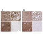 Immunohistochemical staining of human adrenal gland, kidney, pancreas and skeletal muscle using Anti-PACSIN2 antibody HPA056520 (A) shows similar protein distribution across tissues to independent antibody HPA049854 (B).
