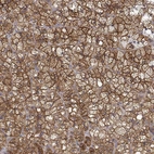 Immunohistochemical staining of human adrenal gland shows strong cytoplasmic and membranous positivity in glandular cells.