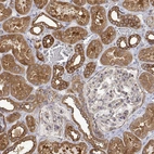 Immunohistochemical staining of human kidney shows moderate to strong cytoplasmic positivity in cells in tubules.