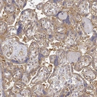 Immunohistochemical staining of human placenta shows weak to moderate cytoplasmic positivity in trophoblastic cells.