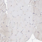 Immunohistochemical staining of human skeletal muscle shows no positivity in myocytes as expected.