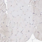 Immunohistochemical staining of human skeletal muscle shows no positivity in myocytes as expected.