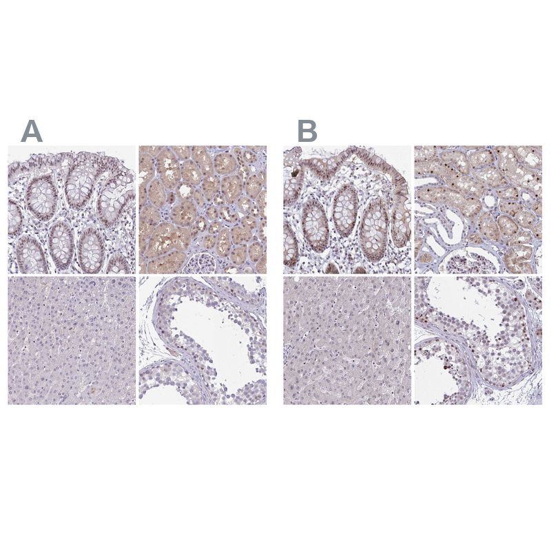 Anti-RBL1 Antibody
