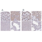 Anti-RBL1 Antibody