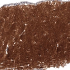 Immunohistochemical staining of human cerebellum shows strong positivity in neuropil.